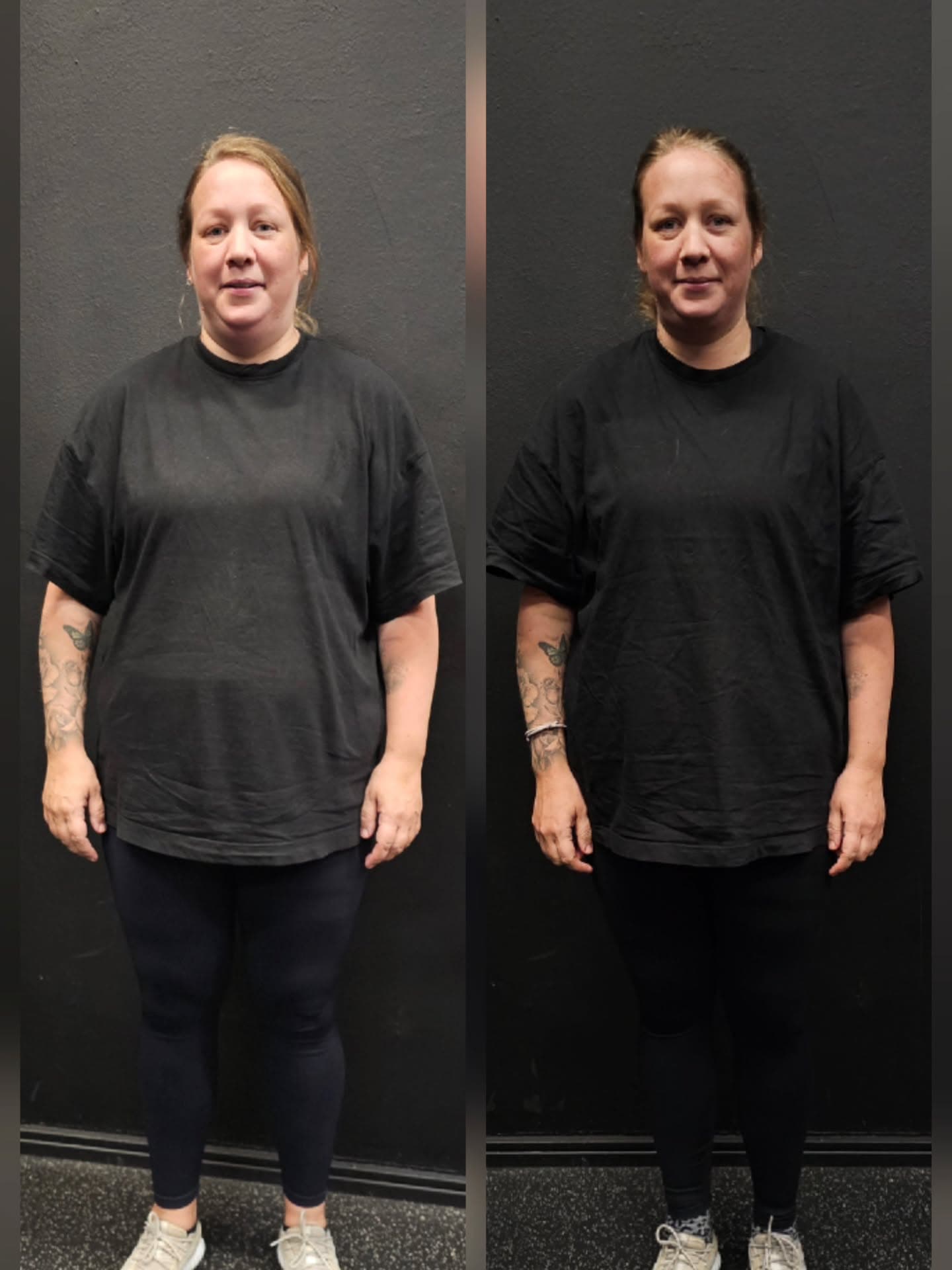 Emma före och efter