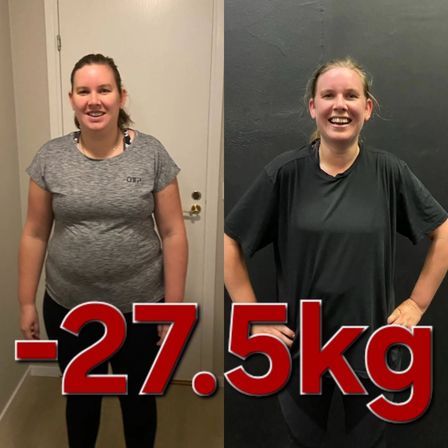 Emma L före och efter